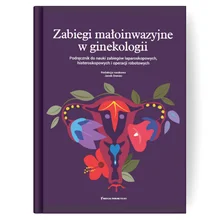 Zabiegi małoinwazyjne w ginekologii. Podręcznik do nauki zabiegów laparoskopowych, histeroskopowych i operacji robotowych