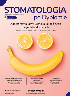 Zastosowanie włókna szklanego w stomatologii
