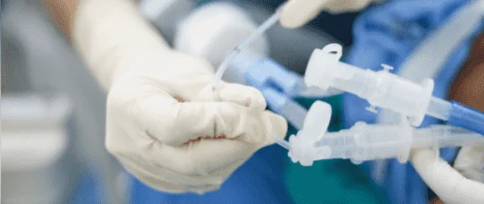 Gigantyczne problemy oddziałów chorób płuc