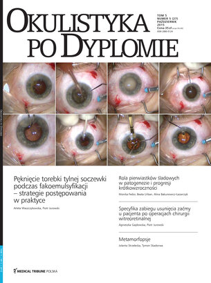Okulistyka po Dyplomie 05/2015