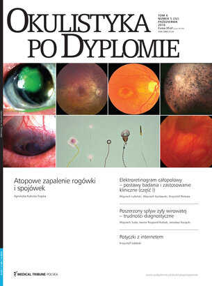Okulistyka po Dyplomie 05/2016