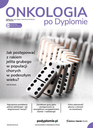 Onkologia po Dyplomie 04/2023