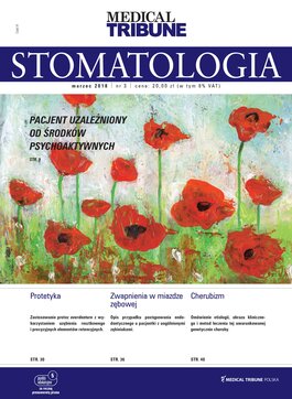 Medical Tribune Stomatologia (03/2018) 