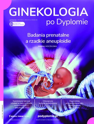 Ginekologia po Dyplomie 06/2023