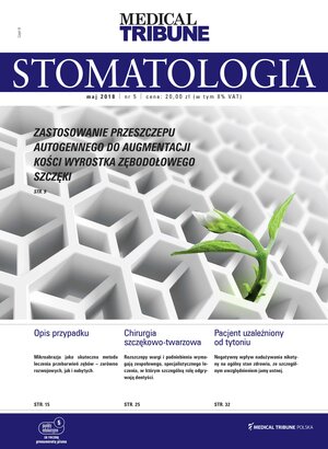 Medical Tribune - stomatologia 05/2018