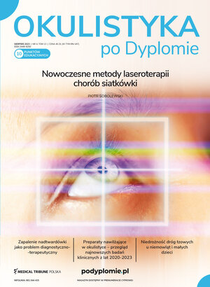 Okulistyka po Dyplomie 04/2023