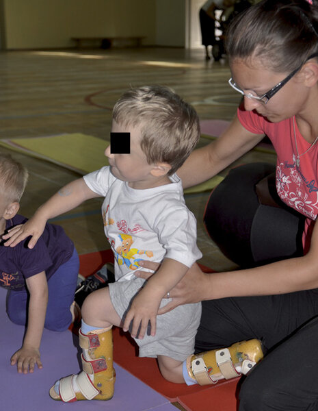 Rycina 6 A i B. Obciążanie osiowe kończyny dolnej.