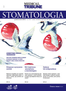 Medical Tribune - stomatologia (10/2016) 