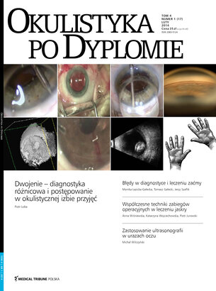 Okulistyka po Dyplomie 01/2014