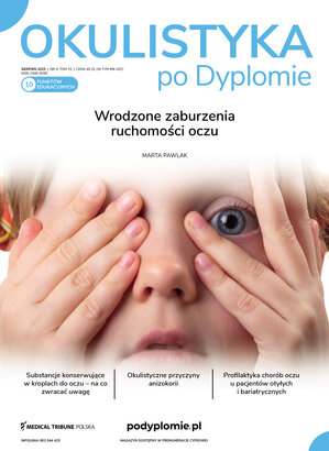 Okulistyka po Dyplomie 04/2025