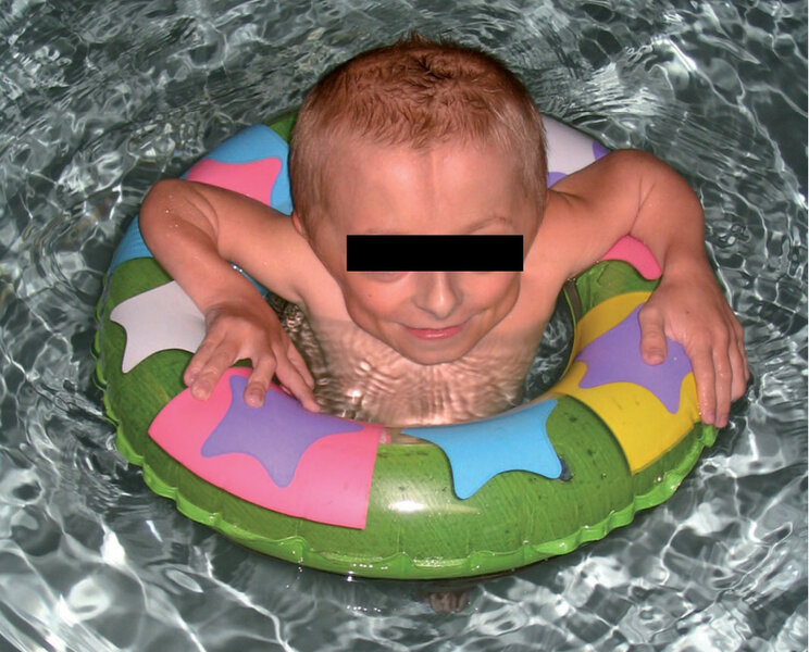 Rycina 3. Ćwiczenia w wodzie w odciążeniu z wykorzystaniem koła.