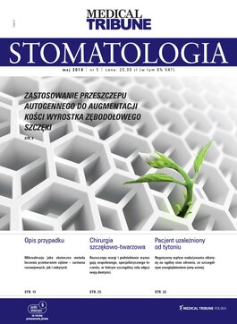 Medical Tribune Stomatologia (05/2018) 