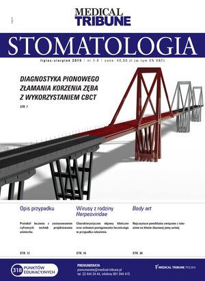 Medical Tribune Stomatologia 07-08/2019