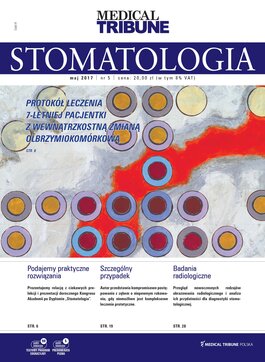 Medical Tribune Stomatologia (05/2017) 
