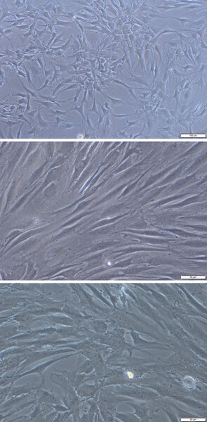 Ryc. 2. Chondrocyty izolowane z tkanki chrzęstnej w dwutygodniowej hodowli in vitro.