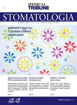 Stomatologia po Dyplomie (06/2017) 