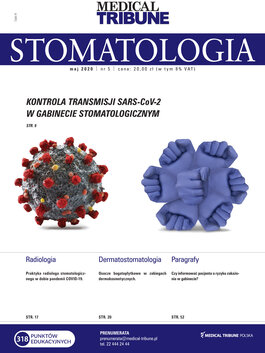 Medical Tribune - stomatologia (05/2020) 
