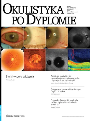 Okulistyka po Dyplomie 03/2016
