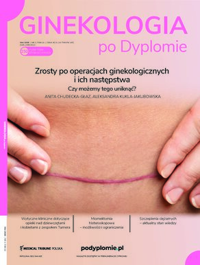 Ginekologia po Dyplomie
