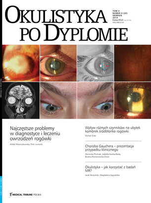 Okulistyka po Dyplomie 04/2014