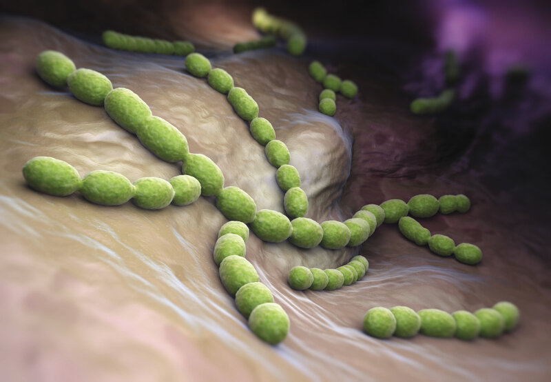 Dwoinka zapalenia płuc&nbsp;(Streptococcus pneumoniae)