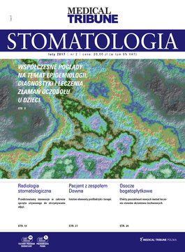 Stomatologia po Dyplomie (02/2017) 