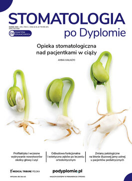 Medical Tribune - stomatologia (02/2023) 
