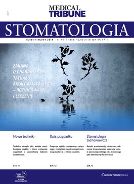 Stomatologia po Dyplomie (07/2018) 