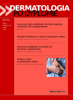 Dermatologia po Dyplomie 04/2012