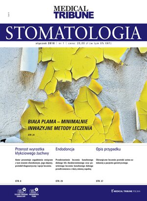 Medical Tribune - stomatologia 01/2018