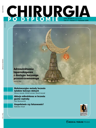 Chirurgia po Dyplomie 02/2016