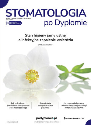 Stomatologia po Dyplomie 03/2022