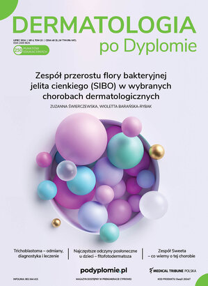 Dermatologia po Dyplomie 04/2024
