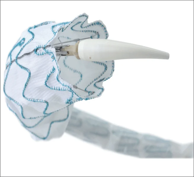 Rycina 2. Stentgraft Relay (Bolton Medical).