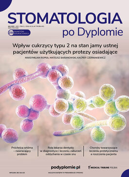 Stomatologia po Dyplomie (03/2025) 