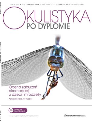 Okulistyka po Dyplomie 04/2018