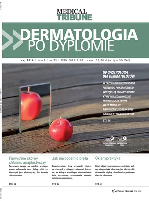 Dermatologia po Dyplomie 03/2016