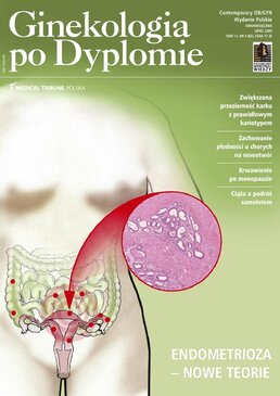 Ginekologia po Dyplomie (04/2009) 