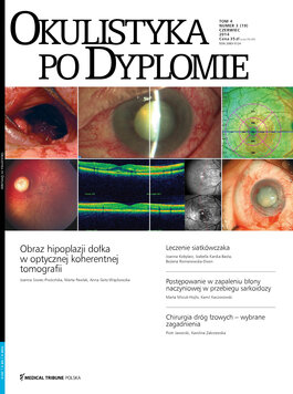 Okulistyka po Dyplomie (03/2014) 