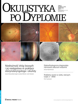 Okulistyka po Dyplomie (02/2017) 