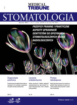 Medical Tribune - stomatologia (03/2017) 