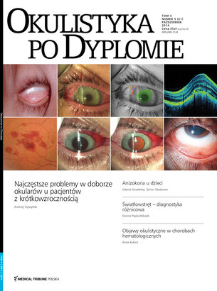 Okulistyka po Dyplomie 05/2014