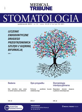 Medical Tribune Stomatologia (10/2019) 
