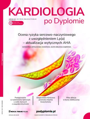 Pilna ablacja w burzy elektrycznej