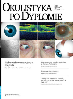 Okulistyka po Dyplomie 06/2013