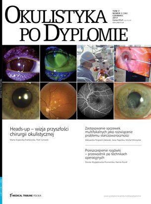 Okulistyka po Dyplomie 03/2017