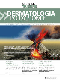 Dermatologia po Dyplomie (06/2013) 