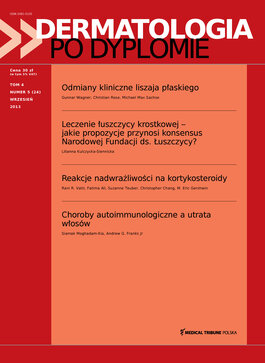 Dermatologia po Dyplomie (05/2013) 