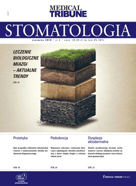 Medical Tribune Stomatologia (06/2018) 