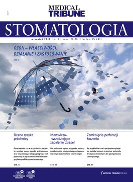 Medical Tribune Stomatologia (09/2017) 